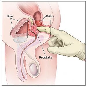 Prostata mit Finger ertasten